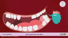 مراحل رشد دندان شیری و دائمی