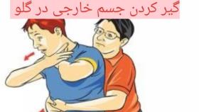 در هنگام گیر کردن جسم خارجی در گلو چه کنیم