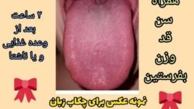 خانم سلطانی09032085369مشاوره رایگان.تشخیص بیماری از روی زبان.زبان شناسی.مزاج شنا