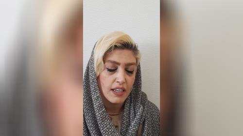 کامپوزیت دندان در اصفهان