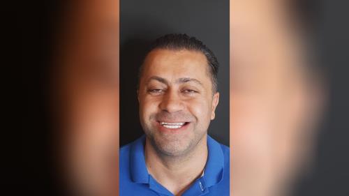 کامپوزیت دندان در اصفهان