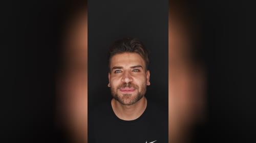 بلیچینگ دندان در اصفهان