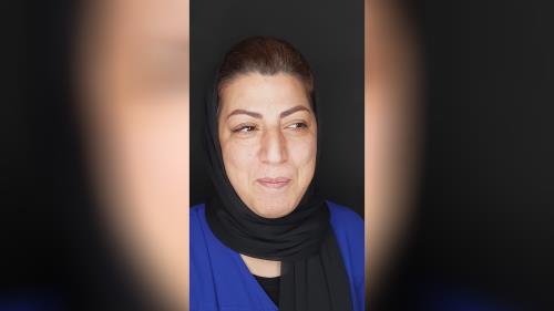 جرمگیری دندان در اصفهان