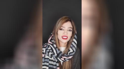 بلیچینگ دندان در اصفهان