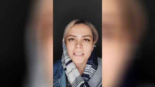 جرمگیری دندان در اصفهان