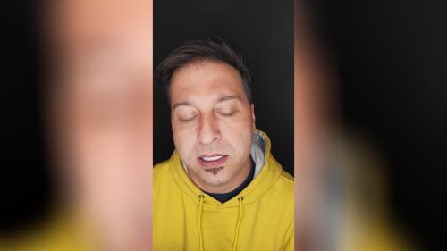 بلیچینگ دندان در اصفهان