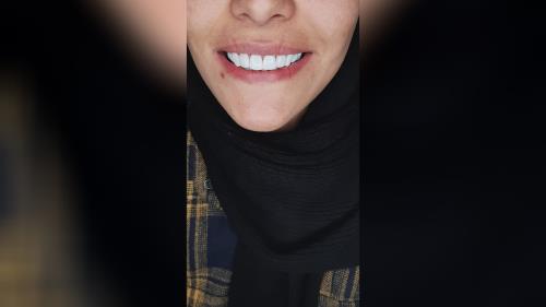 بهترین دکتر طراح لبخند در اصفهان