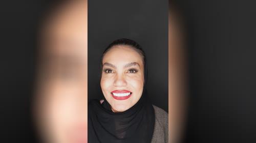 لمینت دندان در اصفهان