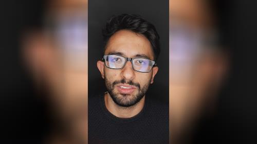 کامپوزیت دندان در اصفهان