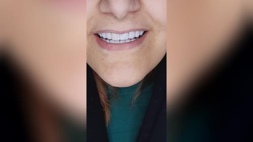 بهترین دکتر طراح لبخند در اصفهان