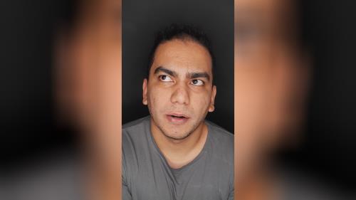 اصلاح طرح لبخند در اصفهان