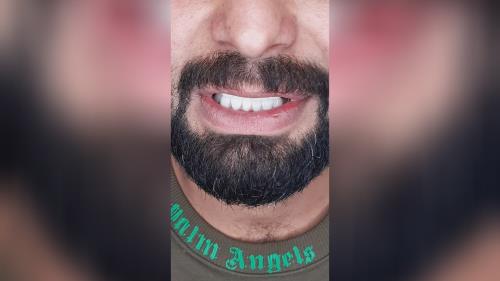 بهترین دکتر طراح لبخند در اصفهان