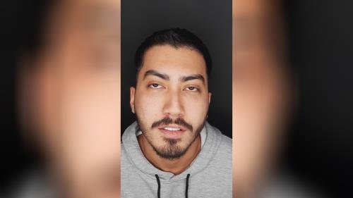 اصلاح طرح لبخند در اصفهان