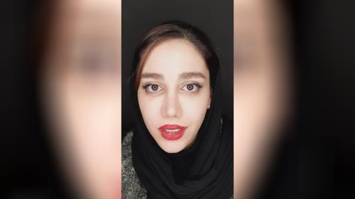 لمینت دندان در اصفهان