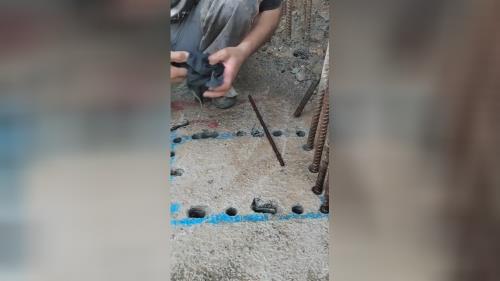 کاشت ارماتور در تهران